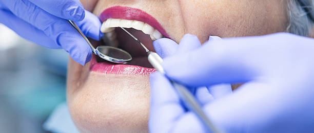 Best Emergency Root Canal Treatment in Brooksville, MS